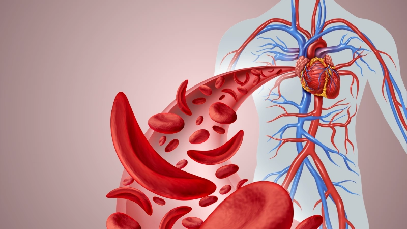 The Hidden Risk of Sickle Cell Awareness Month